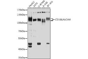 Western blot analysis of extracts of various cell lines, using CD166/CD166/ALCAM antibody (ABIN6127405, ABIN6136759, ABIN6136760 and ABIN6219454) at 1:1000 dilution. (CD166 antibody  (AA 28-180))