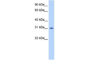WB Suggested Anti-APOBEC2 Antibody Titration:  1. (APOBEC2 antibody  (N-Term))