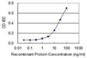 Detection limit for recombinant GST tagged DIP2A is 0. (DIP2A antibody  (AA 107-301))