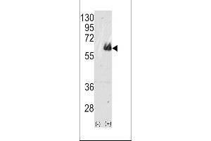 Western blot analysis of TAU(arrow) using rabbit polyclonal TAU Antibody (ABIN388782 and ABIN2839114). (tau antibody  (C-Term))