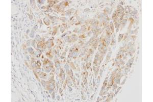 IHC-P Image Immunohistochemical analysis of paraffin-embedded A549 xenograft, using VPS26, antibody at 1:500 dilution. (VPS26A antibody  (C-Term))