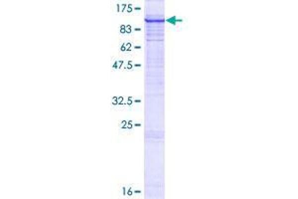 SYVN1 Protein (AA 1-617) (GST tag)