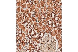 Immunohistochemical analysis of paraffin-embedded human kidney tissue using (ABIN657909 and ABIN2846858) performed on the Leica® BOND RXm. (TRPV1 antibody  (N-Term))