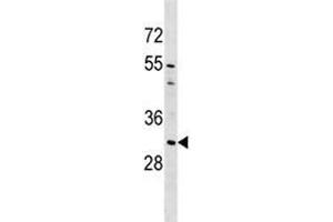 AQP1 antibody western blot analysis in A549 lysate (Aquaporin 1 antibody  (AA 241-269))