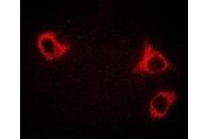 Immunofluorescent analysis of GCN2 staining in HepG2 cells. (GCN2 antibody)