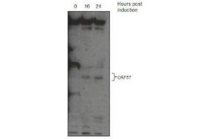 Western Blotting (WB) image for anti-KSHV ORF57 antibody (ABIN2995166) (KSHV ORF57 antibody)
