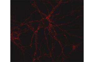 Indirect immunostaining of PFA fixed mouse cortex neurons (dilution 1 : 500) (GABRB3 antibody  (AA 344-429))