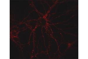 Indirect immunostaining of PFA fixed mouse cortex neurons (dilution 1 : 500)