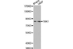 Western blot analysis of extracts of various cell lines, using TBK1 antibody. (TBK1 antibody  (AA 440-729))