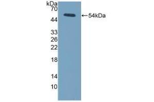 Detection of Recombinant LOX, Mouse using Polyclonal Antibody to Lysyl Oxidase (LOX) (LOX antibody  (AA 207-411))