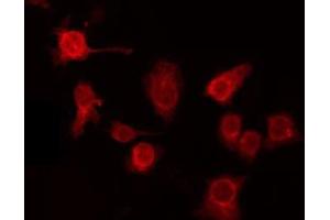 ABIN6275995 staining HepG2 by IF/ICC. (GPR137C antibody  (Internal Region))