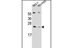 LIN7C Antibody (C-term) (ABIN656734 and ABIN2845958) western blot analysis in MCF-7,NCI- cell line lysates (35 μg/lane). (LIN7C antibody  (C-Term))