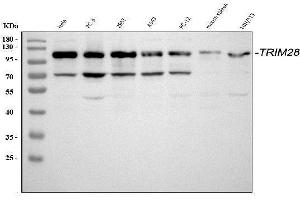 Western blot analysis of KAP1 using anti-KAP1 antibody (ABIN3043491). (KAP1 antibody  (AA 699-835))