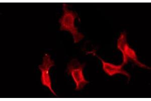 ABIN6274284 staining HepG2 by IF/ICC. (Ephrin A3 antibody  (C-Term))