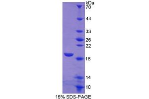 Image no. 1 for Sialic Acid Binding Ig-Like Lectin 7 (SIGLEC7) (AA 381-467) protein (His tag) (ABIN1980998)