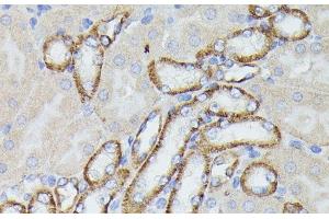 Immunohistochemistry of paraffin-embedded Mouse kidney using LTF Polyclonal Antibody at dilution of 1:100 (40x lens). (Lactoferrin antibody)