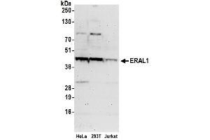anti-Era G-Protein-Like 1 (ERAL1) (AA 75-125) antibody