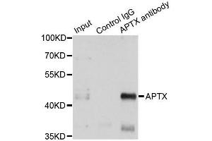 Immunoprecipitation analysis of 150ug extracts of A549 cells using 3ug APTX antibody. (Aprataxin antibody  (AA 93-342))