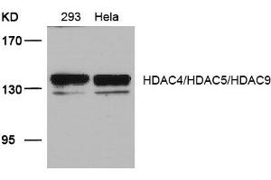 Western blot analysis of extracts from 293 and Hela cells using HDAC4/HDAC5/HDAC9(Ab-246/259/220) Antibody.