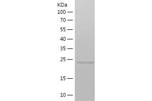 METTL4 Protein (AA 289-463) (His tag)