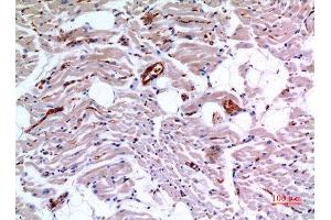 Immunohistochemistry (IHC) analysis of paraffin-embedded Human Heart, antibody was diluted at 1:100. (IDH3A antibody  (Internal Region))