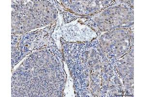 IHC analysis of TP53I13 using anti-TP53I13 antibody (ABIN7601220). (TP53I13 antibody  (AA 30-365))