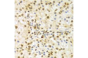 Immunohistochemistry (IHC) image for anti-ELAV (Embryonic Lethal, Abnormal Vision, Drosophila)-Like 1 (Hu Antigen R) (ELAVL1) (AA 1-326) antibody (ABIN3022231)