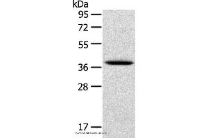 Western blot analysis of Human cervical cancer tissue, using TPM2 Polyclonal Antibody at dilution of 1:750 (TPM2 antibody)