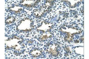 Image no. 1 for anti-Placental Alkaline Phosphatase (ALPP) (AA 411-460) antibody (ABIN203490) (PLAP antibody  (AA 411-460))