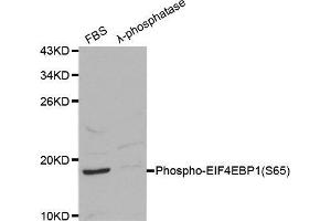 Western blot analysis on 293 cell lysates using Phospho-EIF4EBP1-S65 antibody. (eIF4EBP1 antibody  (pSer65))