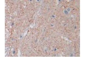IHC-P analysis of Rat Spinal Cord Tissue, with DAB staining. (PTPRB antibody  (AA 1041-1310))