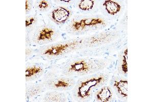 Immunohistochemistry of paraffin-embedded mouse kidney using SLC3 Rabbit pAb (ABIN6132663, ABIN6147998, ABIN6147999 and ABIN6221169) at dilution of 1:200 (40x lens). (SLC3A1 antibody  (AA 416-685))