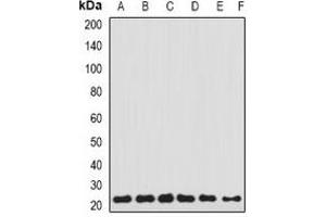 Western blot analysis of Transgelin-2 expression in HEK293T (A), Hela (B), THP1 (C), MCF7 (D), SKOV3 (E), mouse lung (F) whole cell lysates. (TAGLN2 antibody)