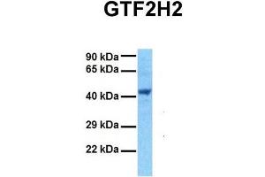Host:  Rabbit  Target Name:  GTF2H2  Sample Tissue:  Human 293T  Antibody Dilution:  1. (GTF2H2 antibody  (Middle Region))