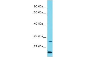 Host: Rabbit Target Name: C10orf95 Sample Type: Jurkat Whole Cell lysates Antibody Dilution: 1. (C10ORF95 antibody  (N-Term))