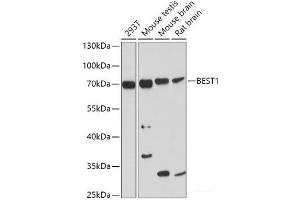 Western blot analysis of extracts of various cell lines using BEST1 Polyclonal Antibody at dilution of 1:1000. (Bestrophin 1 antibody)