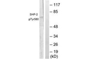 Western blot analysis of extracts from A431 cells, using SHP-2 (Phospho-Tyr580) Antibody. (PTPN11 antibody  (pTyr580))