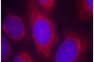 Image no. 1 for anti-Protein Phosphatase 1, Regulatory (Inhibitor) Subunit 14A (PPP1R14A) (Isoform alpha), (Thr38) antibody (ABIN401631) (CPI-17 antibody  (Isoform alpha, Thr38))