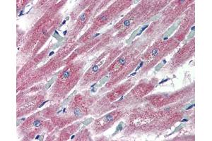 Immunohistochemistry (IHC) image for anti-Pleckstrin Homology Domain Containing, Family H (With MyTH4 Domain) Member 2 (PLEKHH2) (C-Term) antibody (ABIN2785296) (PLEKHH2 antibody  (C-Term))