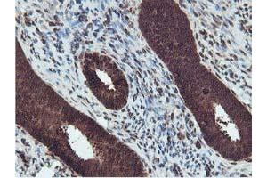 Immunohistochemical staining of paraffin-embedded Human endometrium tissue using anti-RUVBL2 mouse monoclonal antibody.