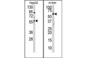 Image no. 1 for anti-24-Dehydrocholesterol Reductase (DHCR24) (N-Term) antibody (ABIN358014) (Seladin 1 antibody  (N-Term))