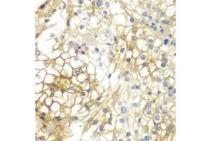 Immunohistochemistry (IHC) image for anti-Syndecan 1 (SDC1) (AA 25-240) antibody (ABIN3021805) (Syndecan 1 antibody  (AA 25-240))