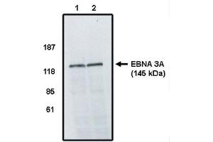 Western Blot analysis using EBV EBNA 3A Antibody on cell lines infected with Epstein Barr Virus. (EBV antibody)