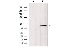 Western blot analysis of extracts from HepG2, using PIAS1 Antibody. (PIAS1 antibody  (N-Term))