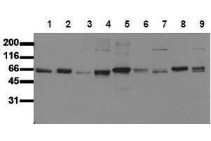 Western Blotting (WB) image for anti-SHC (Src Homology 2 Domain Containing) Transforming Protein 1 (SHC1) (N-Term) antibody (ABIN126890) (SHC1 antibody  (N-Term))