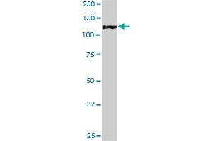 MAP3K13 monoclonal antibody (M04), clone 4H7. (MAP3K13 antibody  (AA 711-810))