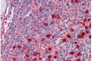 Human Spleen: Formalin-Fixed, Paraffin-Embedded (FFPE) (RPL5 antibody  (AA 35-84))