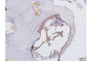 Formalin-fixed and paraffin embedded rat shin bone labeled with Anti-Osteopontin Polyclonal Antibody, Unconjugated (ABIN723800) at 1:300 followed by conjugation to the secondary antibody and DAB staining