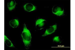 Immunofluorescence of purified MaxPab antibody to PLOD3 on HeLa cell. (PLOD3 antibody  (AA 1-738))
