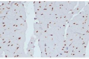 Immunohistochemistry of paraffin-embedded Rat heart using Phospho-CHEK1(S280) Polyclonal Antibody at dilution of 1:100 (40x lens). (CHEK1 antibody  (pSer280))